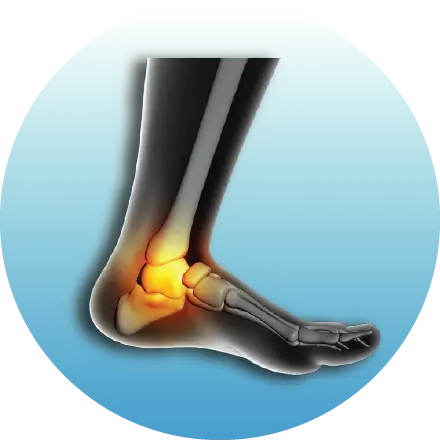 Joint / Arthritis  & Bone Health Test / Packages